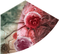 Симптоми на Онкологични заболявания