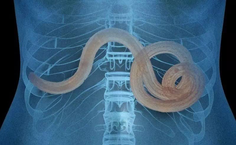 Изображение на паразити 1