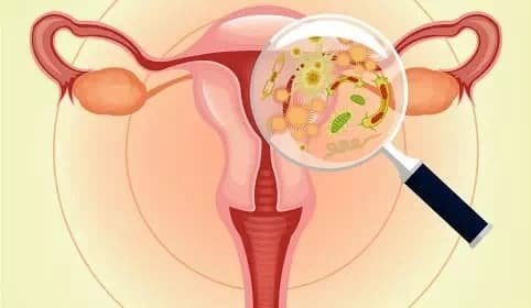 Изображение на паразити 2